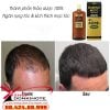 thuốc kích thích mọc tóc kaminomoto Higher Strength Nhật kích thích mọc tóc nhanh gấp 3 lần so với bình thường
