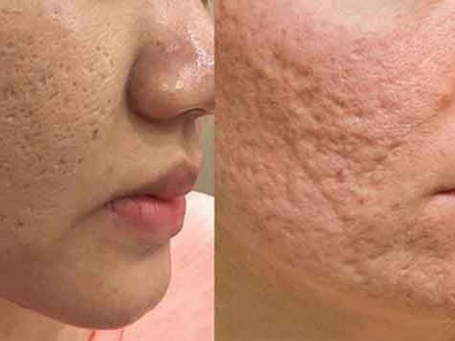 Donkihote - Địa chỉ cung cấp kem trị sẹo nội địa Nhật uy tín