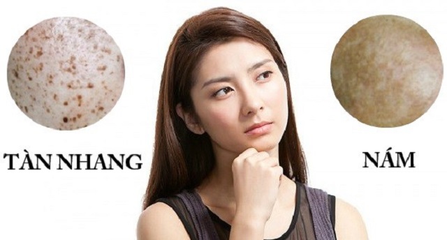 Nám và tàn nhang biểu hiện trên da như thế nào