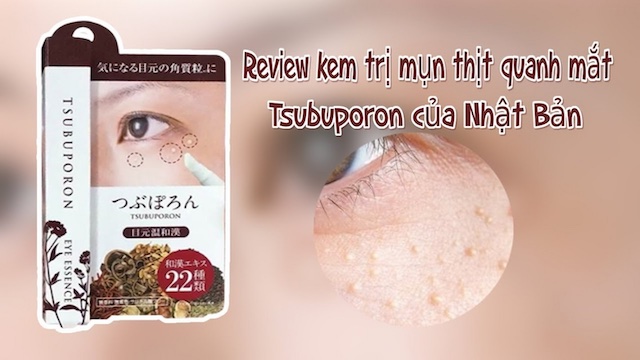 Tsubuporon điều trị mụn thịt ngay tại nhà