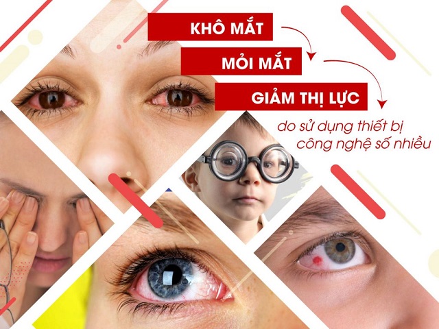 Tại sao cần chăm sóc mắt