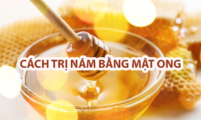 Trị nám thật dễ dàng và hiệu quả với mật ong